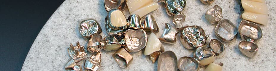 パラジウム特徴イメージ