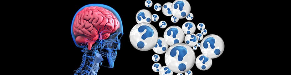 サイコロジカルラインとはイメージ